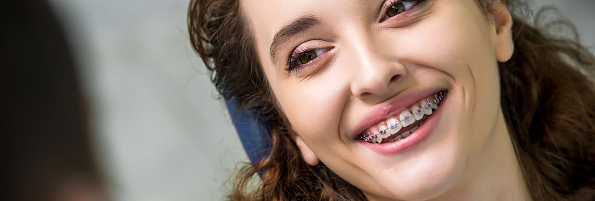Straight talk about self-ligating braces, an “elastics-free” alternative to conventional orthodontic treatment
